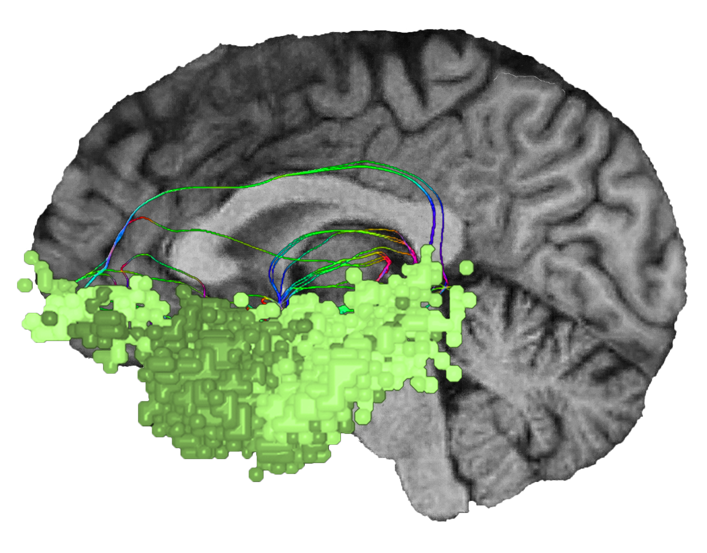 BN-Limbic