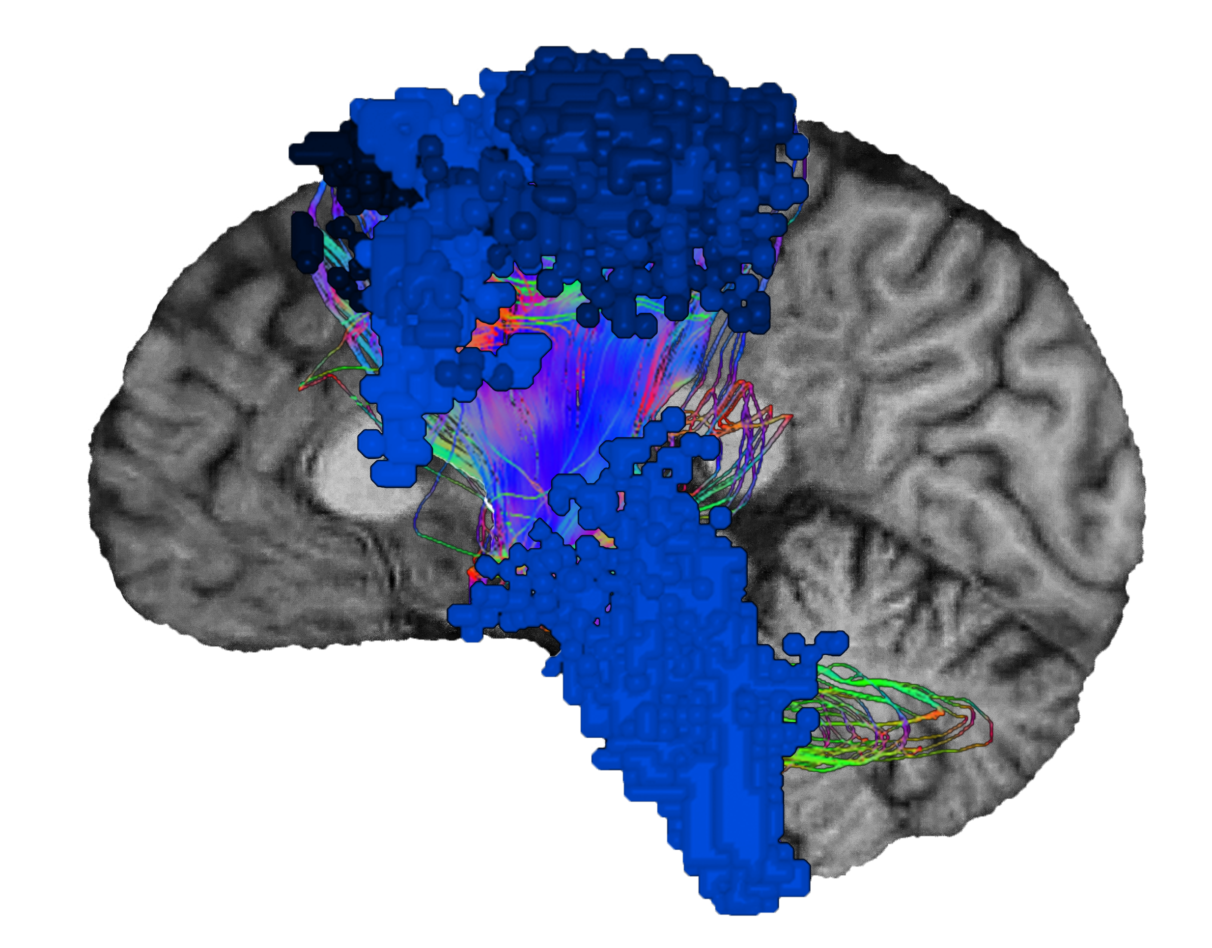 The Sensorimotor Network