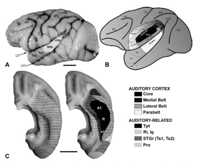 The auditory system