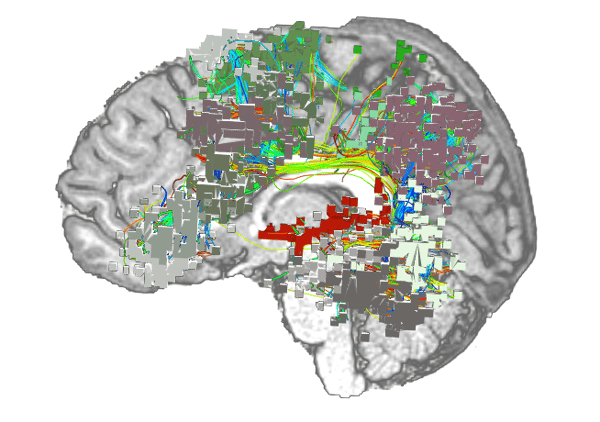 applying big data to human brain network