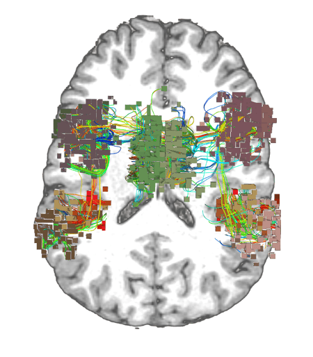 complex brain auditory network responsible for hearing