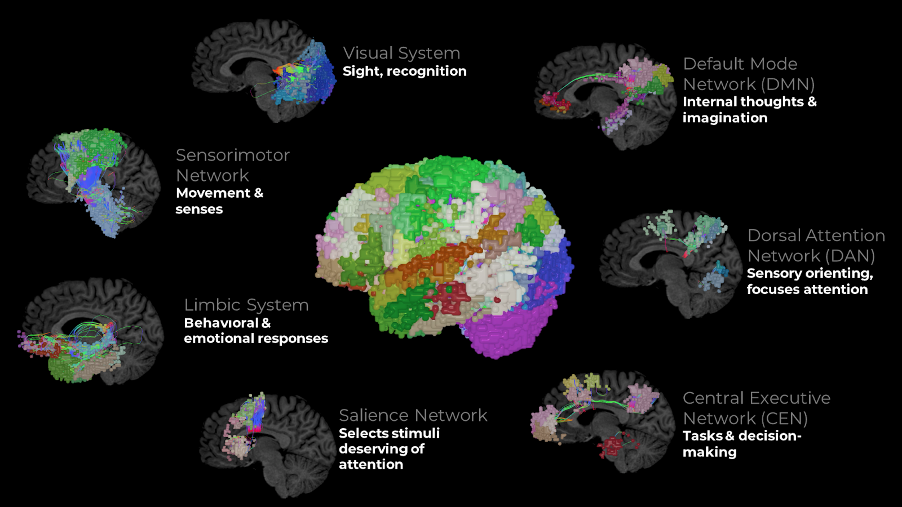 Figure1 - The brain's major networks