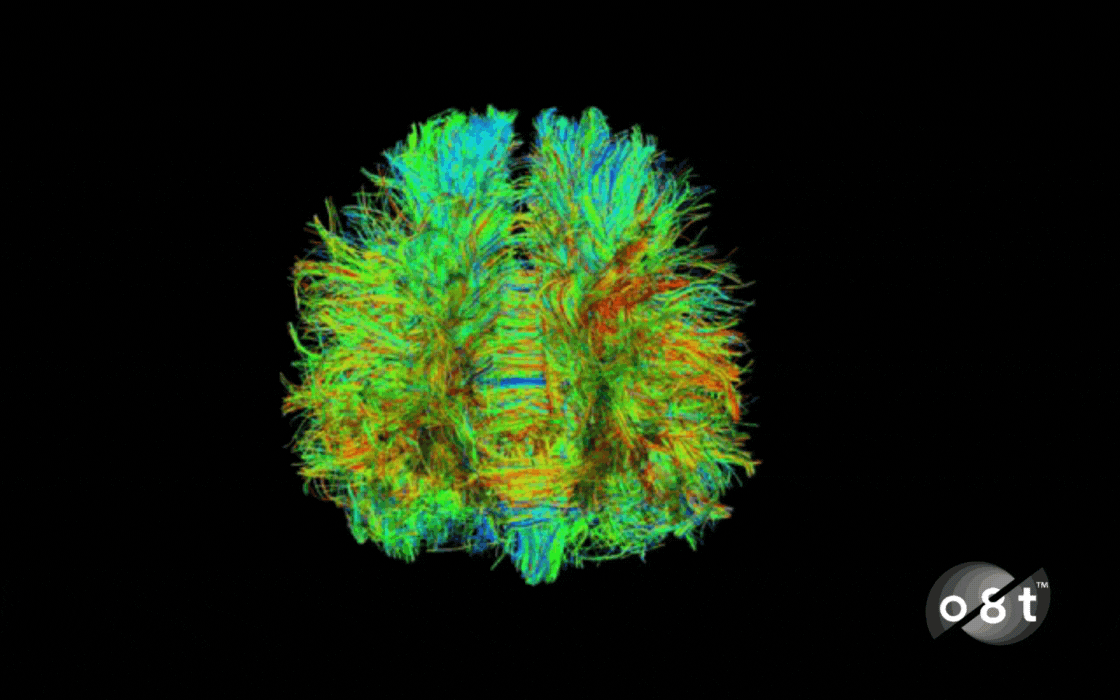 Tractography GIF