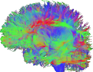 brain maps transparent