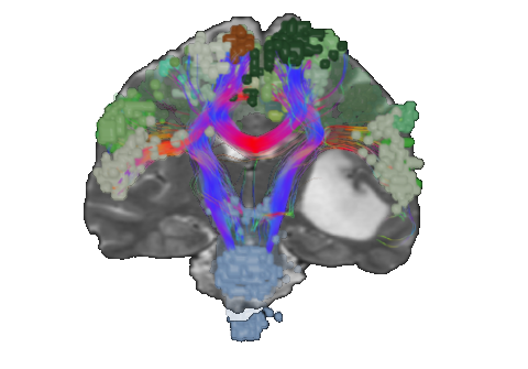 Network based neurosurgery 