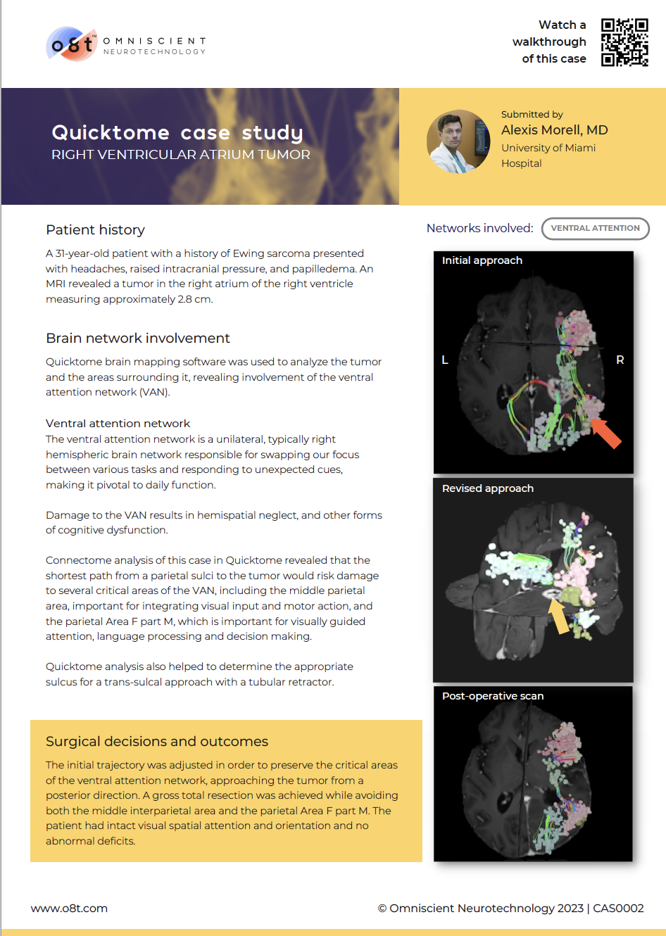 Case study - right ventricular atrium tumor