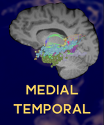 MEDIAL_TEMPORAL_THUMBNAIL