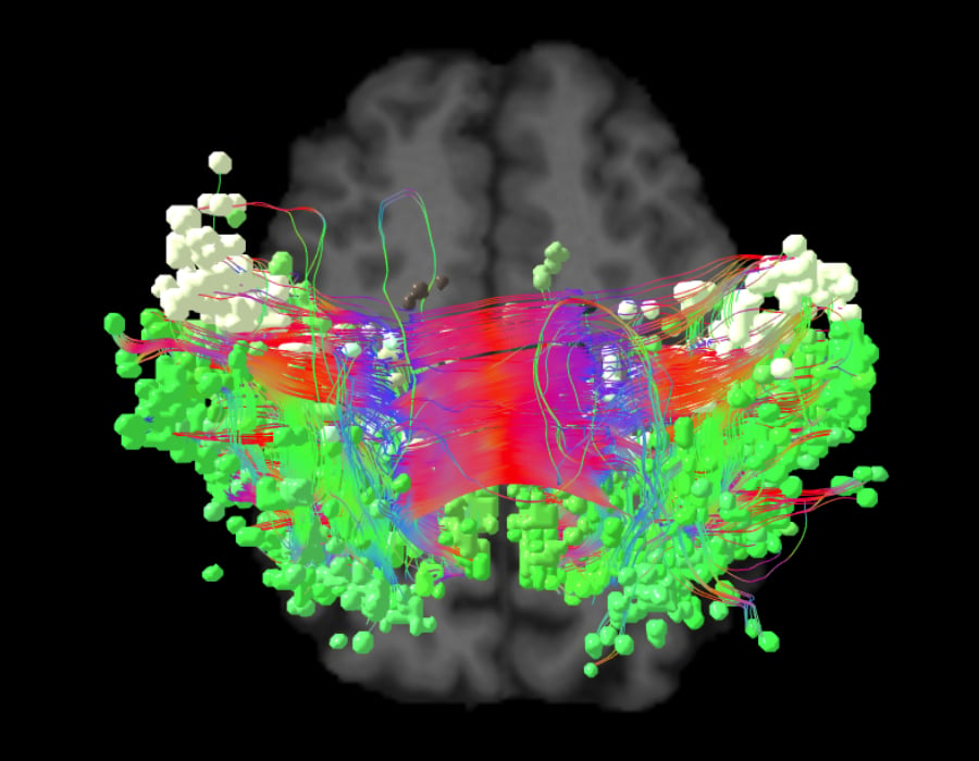 SENSORIMOTOR_AXI