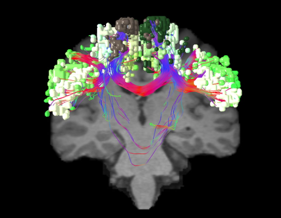 SENSORIMOTOR_COR