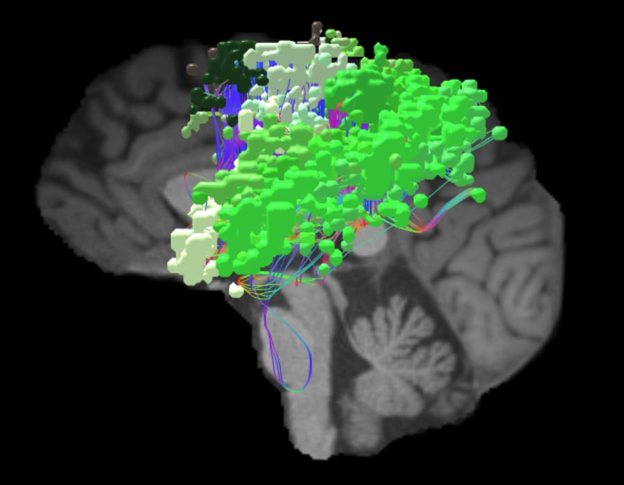 SENSORIMOTOR_SAG